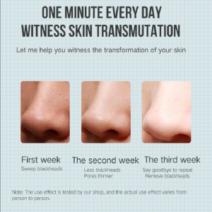 Máy ép điện Loại bỏ mụn trứng cá Loại bỏ mụn đầu đen Máy làm đẹp chân không Pore Cleaner